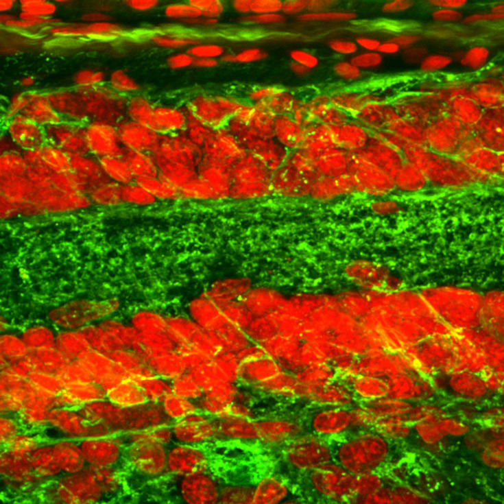 cell nucleus (red), nerve fibre (green)