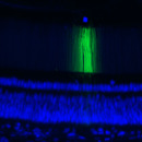 cell nucleus (blue), nerve fibre (green)
